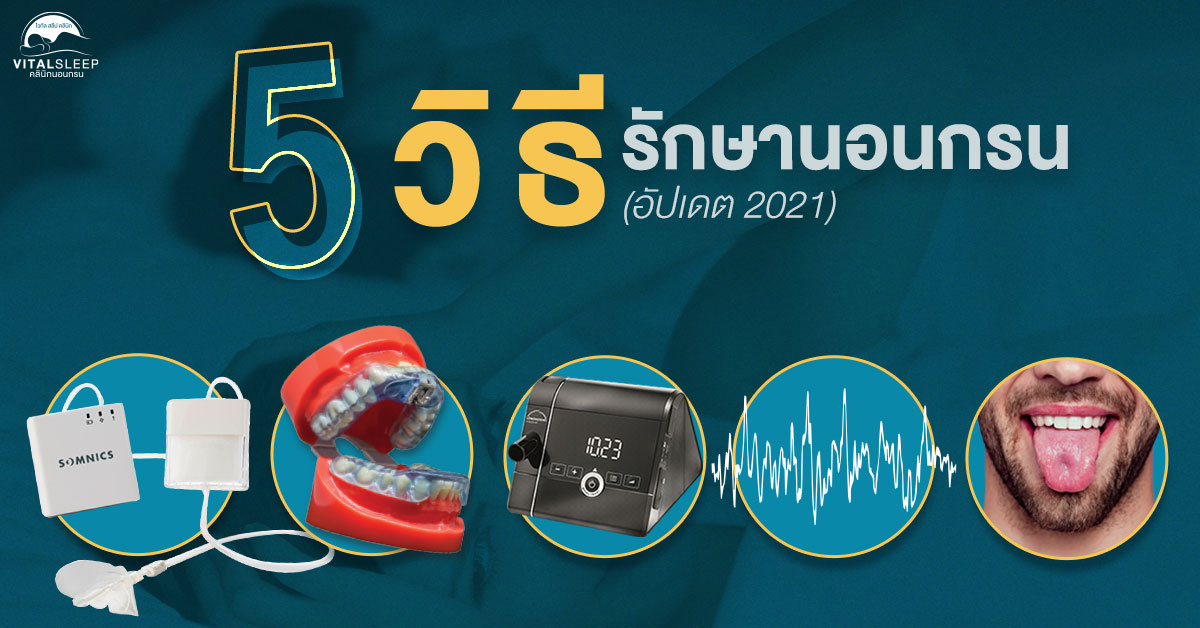 อุปกรณ์รักษานอนกรน โดยไม่ต้องใช้วิธีการผ่าตัด ในปี 2021