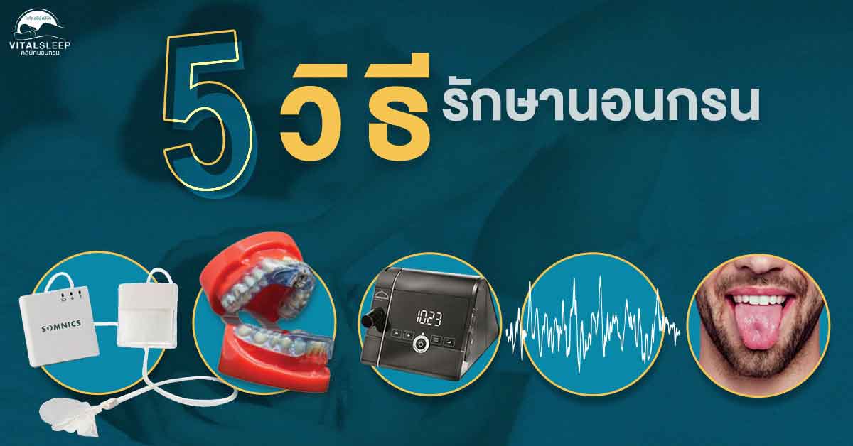 อัปเดต 5 อุปกรณ์รักษานอนกรน