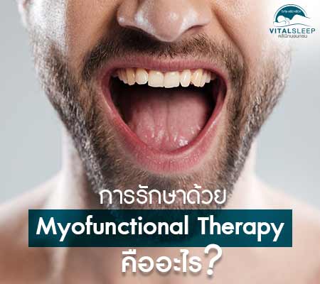 AD AVL2102001= AVL- การรักษาด้วย Myofunctional Therapy คืออะไร