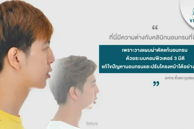 การผ่าตัดนอนกรน โรคนอนกรนรักษา ผ่าตัดแก้นอนกรน นอนกรน แก้นอนกรน