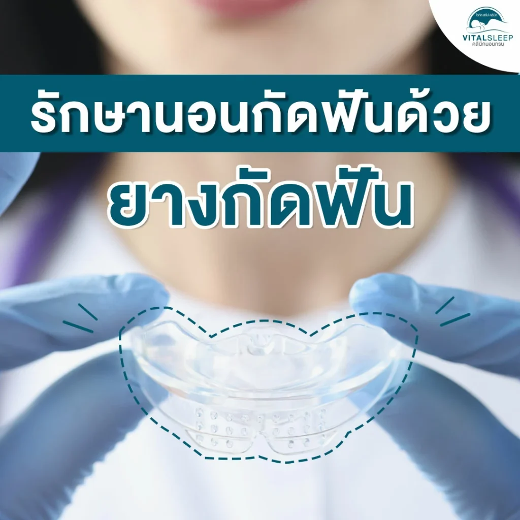 วิธีทางทันตกรรม ช่วยรักษานอนกัดฟัน