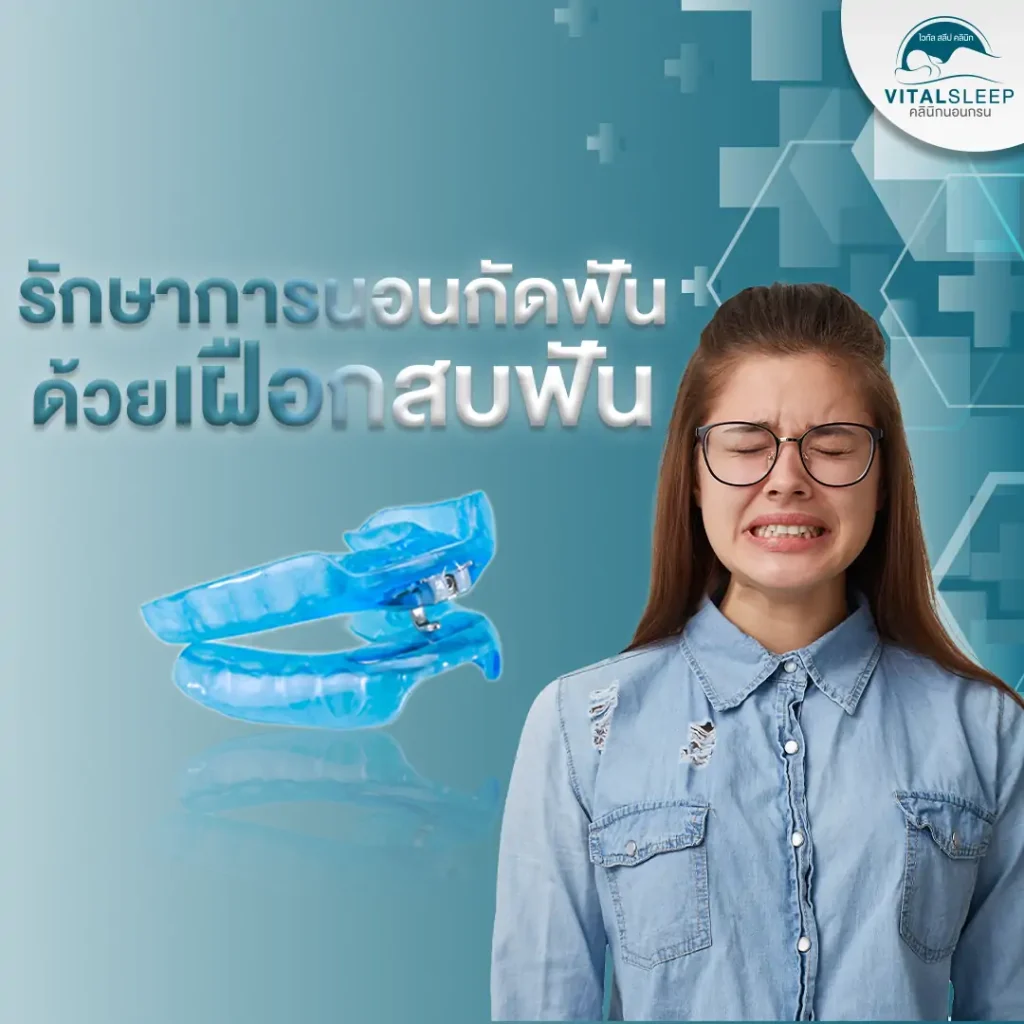 12. เฝือกสบฟันสามารถใช้รักษาอาการนอนกัดฟัน ใส่ตอนนอนเพื่อช่วยให้อาการอักเสบดีขึ้น