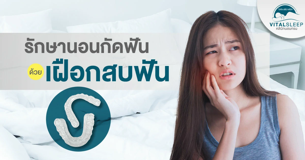 รักษาการนอนกัดฟันด้วยเฝือกสบฟัน