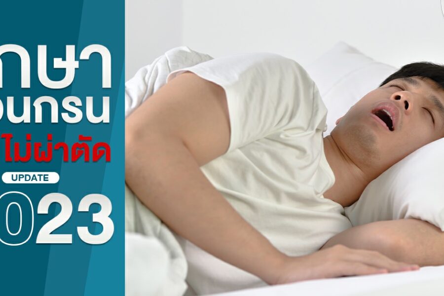รักษานอนกรนแบบไม่ผ่าตัดอัปเดต 2023